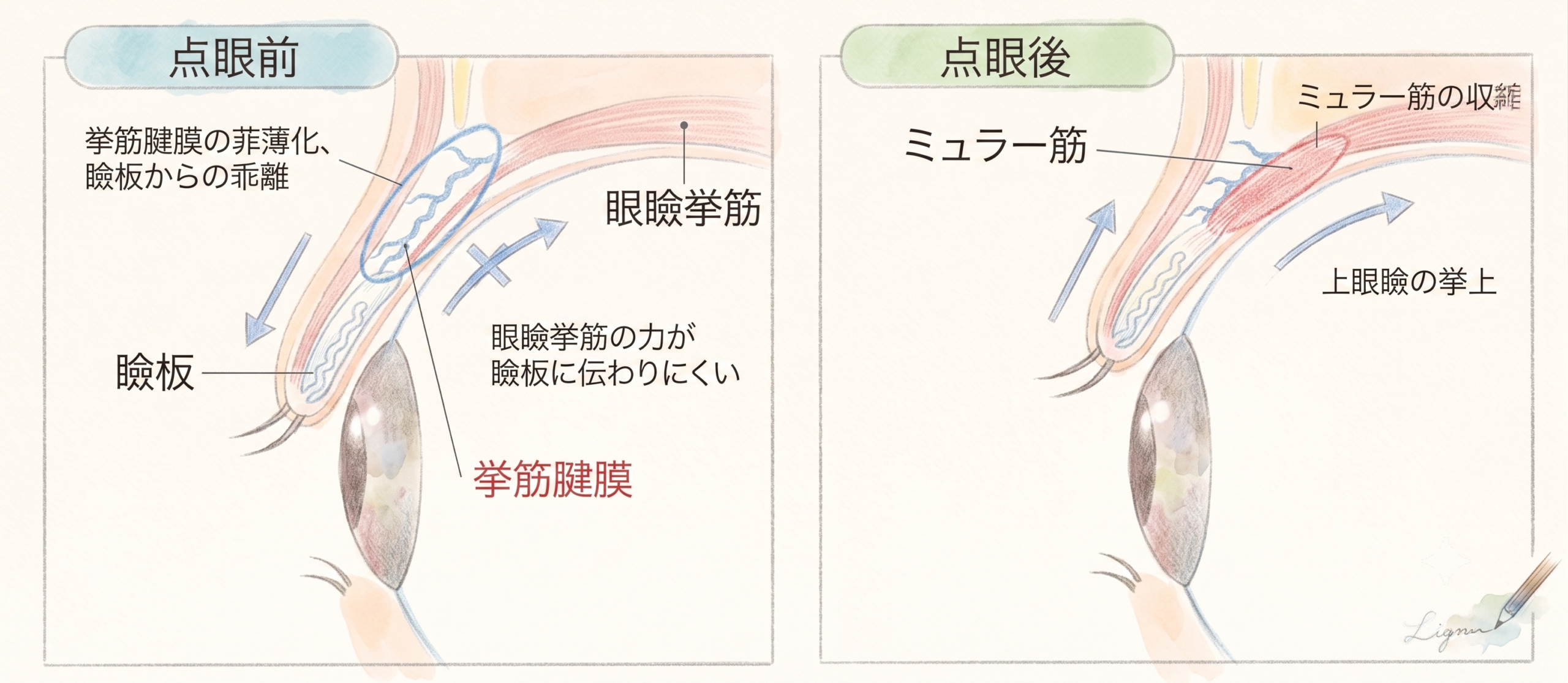 アップニークミニ点眼液の作用機序